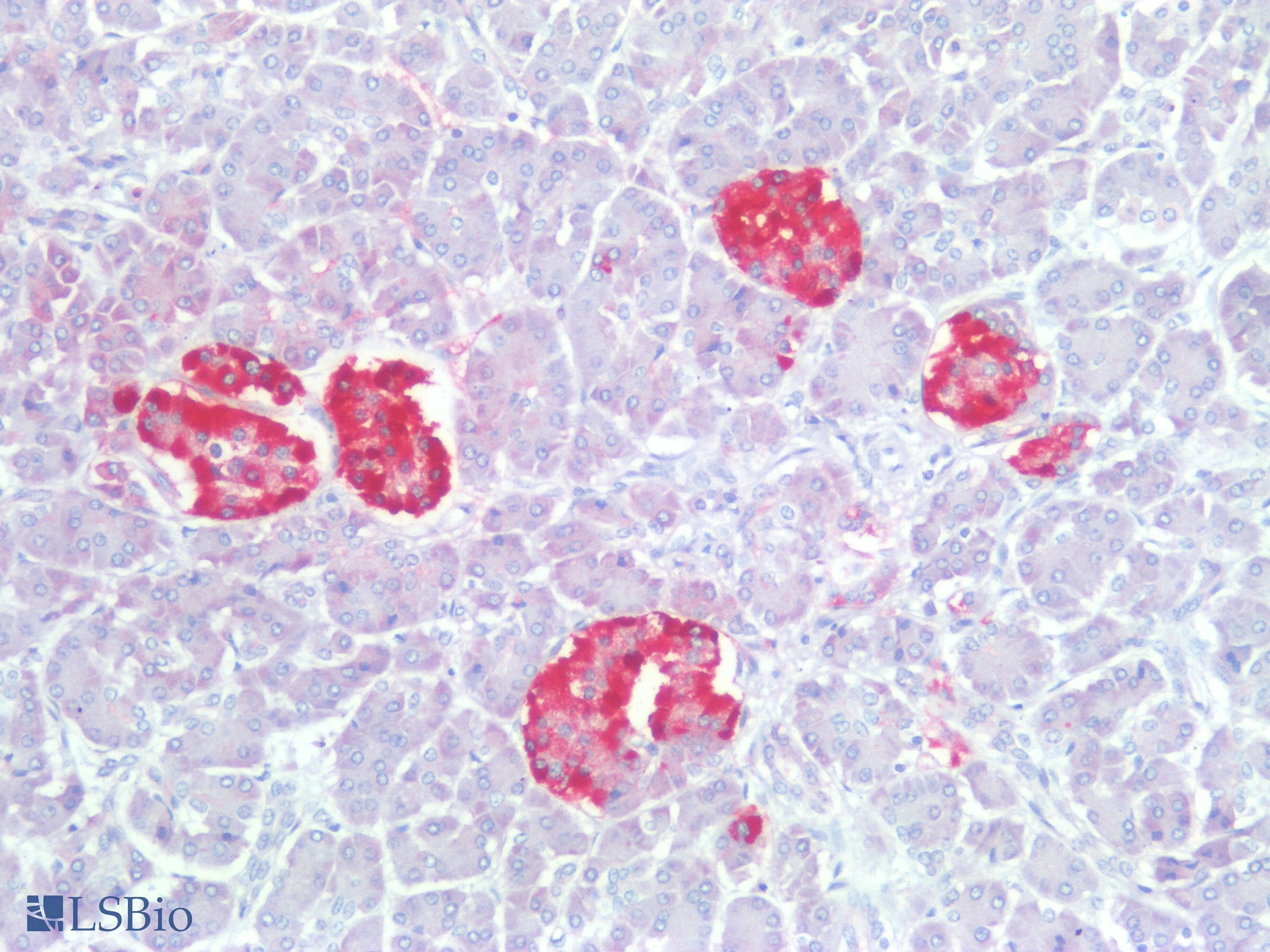 PathPlus™ Polyclonal Rabbit anti-Human CHGA / Chromogranin A Antibody (IHC)