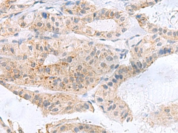 Polyclonal Rabbit anti-Human PHLDA3 Antibody (IHC)
