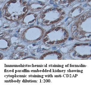 CD2AP Antibody (C-Terminus)