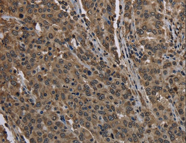 Polyclonal Rabbit anti-Human HIST1H2AH Antibody (IHC, WB)