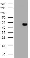 TUBAL3 Antibody (aa150-446, clone OTI4D9, Carrier-free)