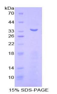 Mouse MMP7 / Matrilysin Protein (Recombinant His-T7)