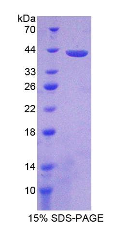 Rat PPP2R4 Protein (Recombinant His-T7)