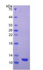 Human ESR2 / ER Beta Protein (Recombinant His)