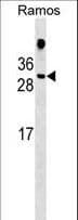 HDGFL1 Antibody (aa110-138)