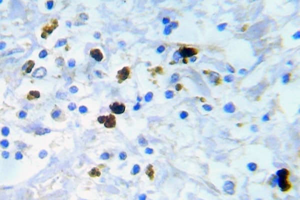 CDK1 / CDC2 Antibody (phospho-Tyr15)