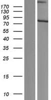 SCMH1 Protein (Over-Expression Lysate Myc-DDK (Flag))