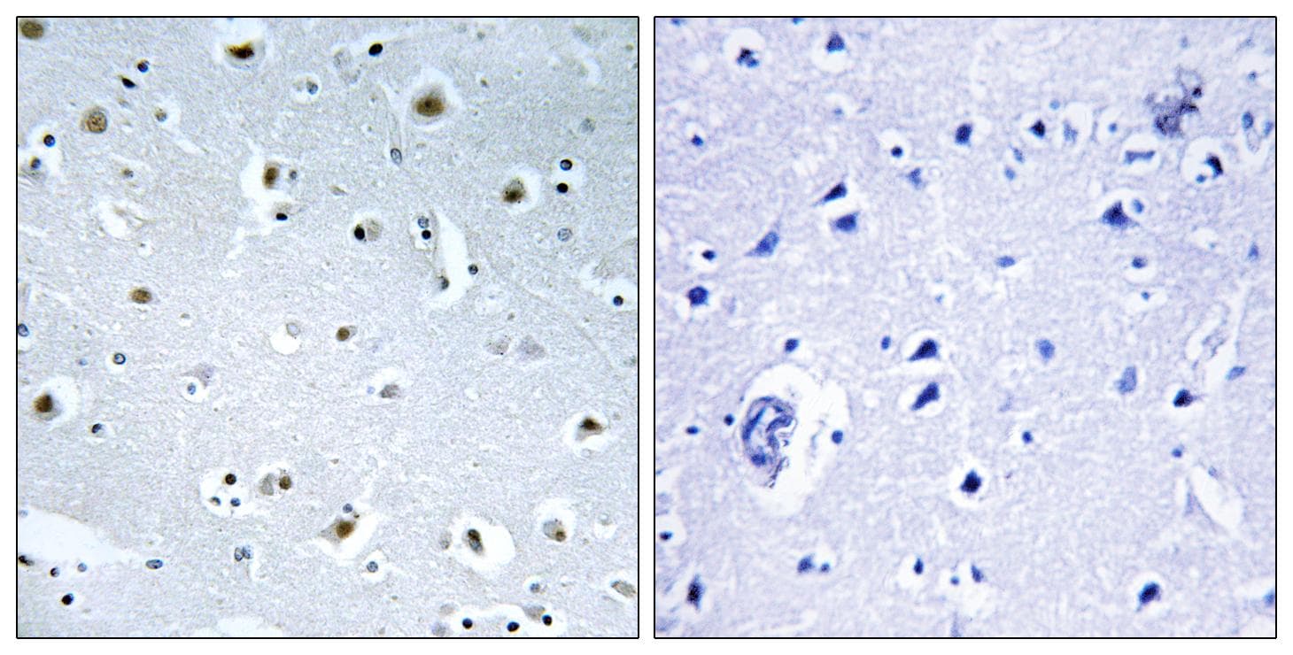 GCP3 / TUBGCP3 Antibody