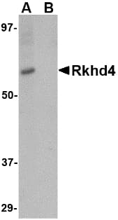 Polyclonal Rabbit anti-Human MEX3A Antibody (IHC, IF, WB)