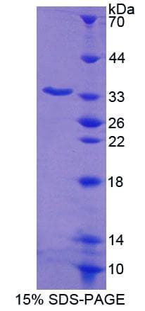 Human UMPS / OPRT Protein (Recombinant His-T7)