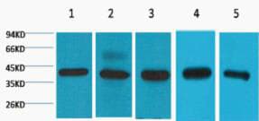 IHC-plus™ EIF4A1 Antibody (clone M8)