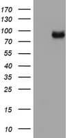 MDM2 Antibody (clone OTI1B4)
