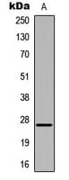 Polyclonal Rabbit anti-Human HOXA6 Antibody (Internal, WB)