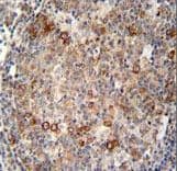 ABCC10 Antibody (aa767-793)