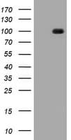Monoclonal Mouse anti-Human CDH1 / E Cadherin Antibody (clone OTI2F9, IHC, WB)
