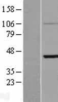 KRT33B / Keratin 33B / KRTHA3B Protein (Over-Expression Lysate Myc-DDK (Flag))