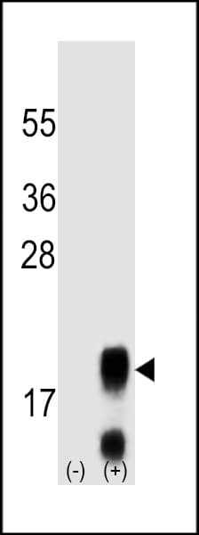 PathPlus™ Monoclonal Mouse anti-Human FSHB / FSH Beta Antibody (clone 365CT24.1.1, aa36-64, IHC, WB)