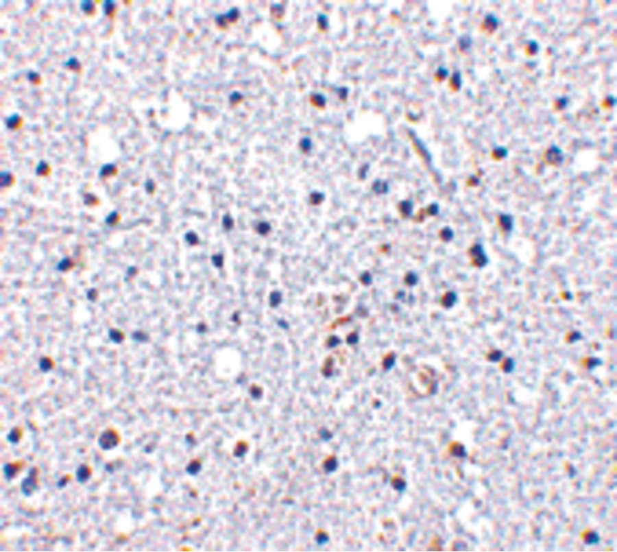 Polyclonal Rabbit anti-Human ACKR1 / DARC Antibody (IHC, IF, WB)