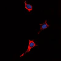 IHC-plus™ P2RY4 / P2Y4 Antibody (Internal)