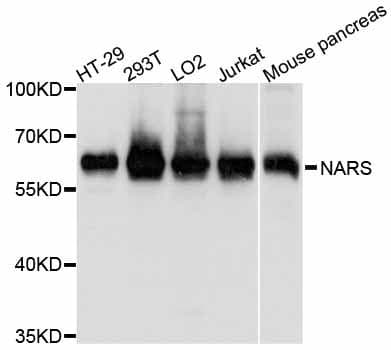 Polyclonal Rabbit anti-Human NARS Antibody (WB)
