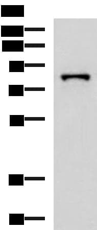 PRPF3 Antibody
