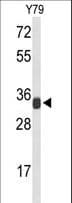 Polyclonal Rabbit anti-Human RPL5 / Ribosomal Protein L5 Antibody (aa1-30, IHC, WB)