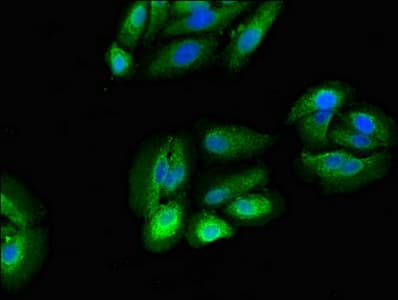 RPS5 / Ribosomal Protein S5 Antibody
