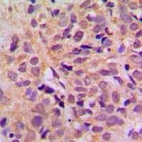 DDX3 / DDX3X Antibody (Internal)