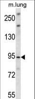 Polyclonal Rabbit anti-Human UNC45B Antibody (aa235-264, IHC, WB)