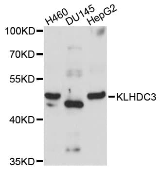 KLHDC3 Antibody
