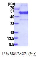 Human KLF12 Protein (Recombinant His)