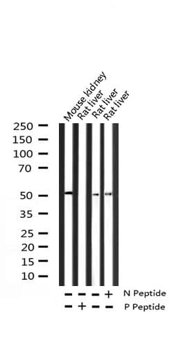 Polyclonal Rabbit anti-Human HNF4A / HNF4 Antibody (phospho-Ser313, IHC, IF, WB)