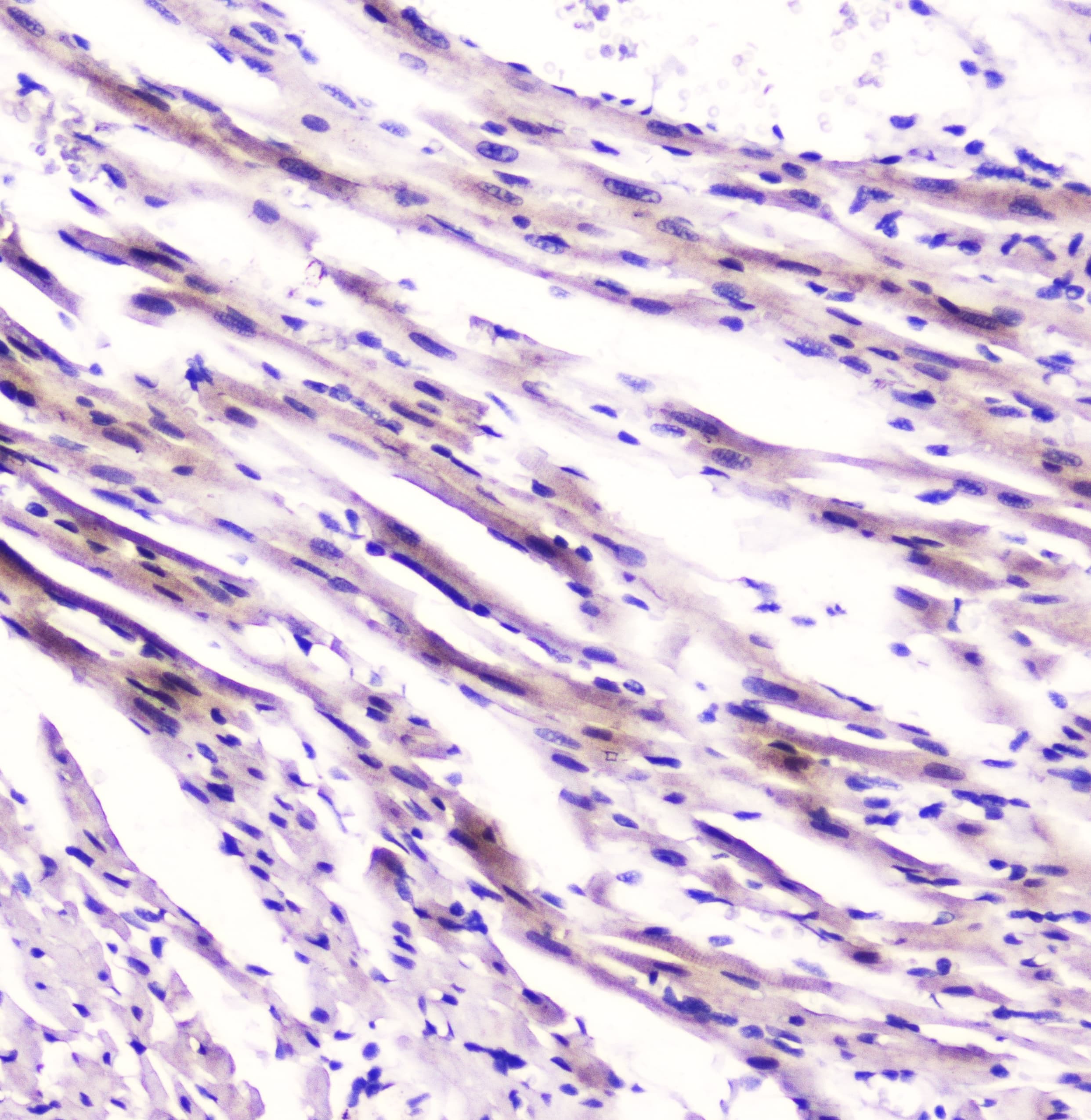 FABP3 / H-FABP Antibody