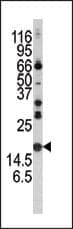 SNCA / Alpha-Synuclein Antibody (aa104-133)