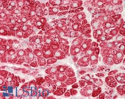 IHC-plus™ Monoclonal Mouse anti-Human RELA / NFKB p65 Antibody (clone 6H7, aa136-224, IHC, WB)