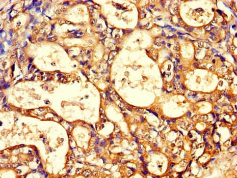 Polyclonal Rabbit anti-Human CCT8 Antibody (IHC, IF, WB)