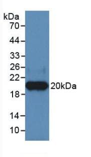 HPSE / Heparanase Antibody (APC)