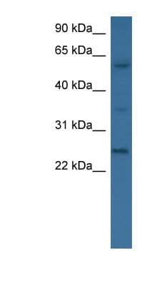 BMP6 Antibody (aa46-95)