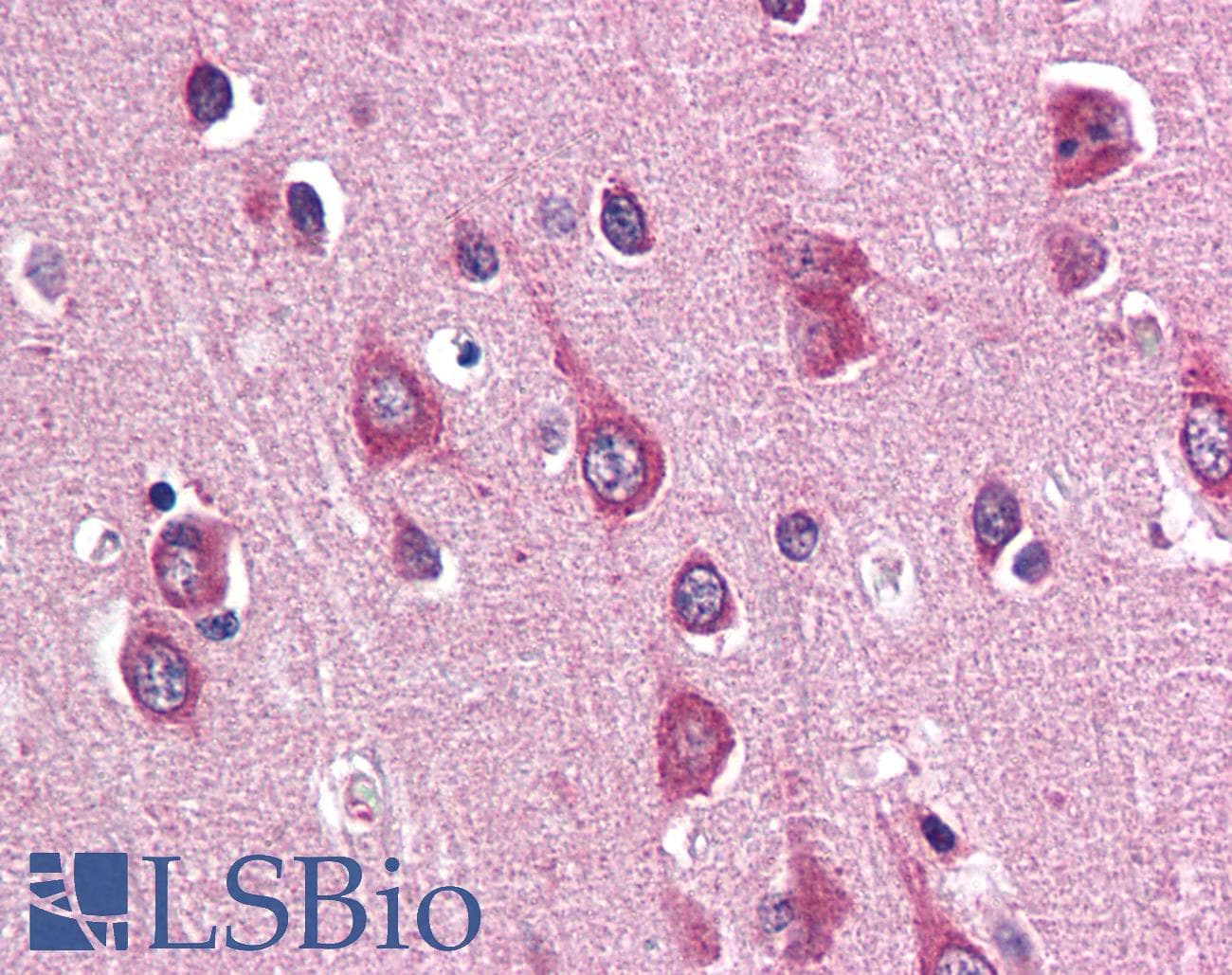 IHC-plus™ PAK3 Antibody (N-Terminus)