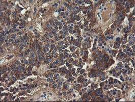 UBE2J1 Antibody (clone OTI3D1)