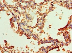 Alpha-1-Antichymotrypsin Antibody (aa24-423)