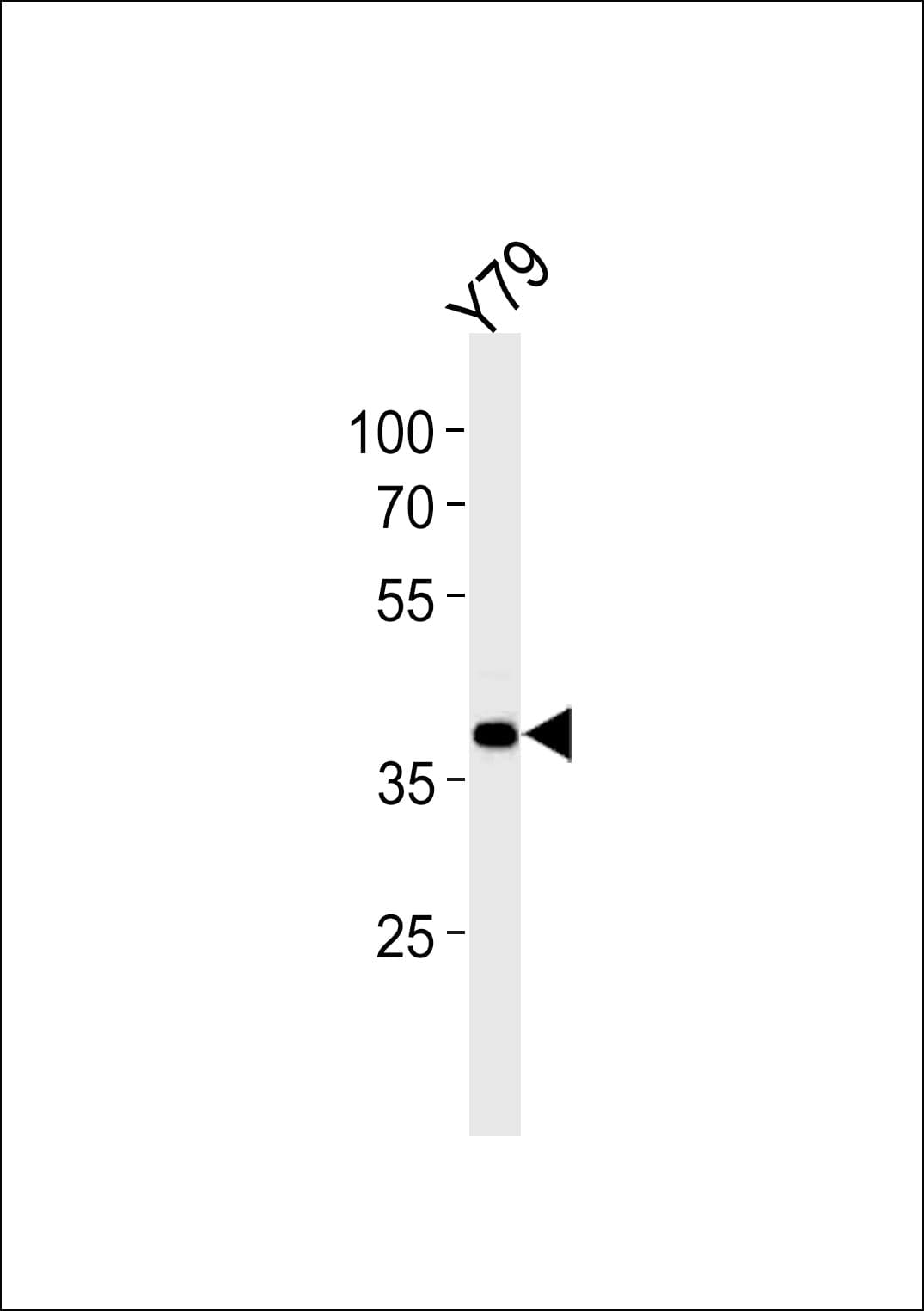 SIX3 Antibody (aa138-166)