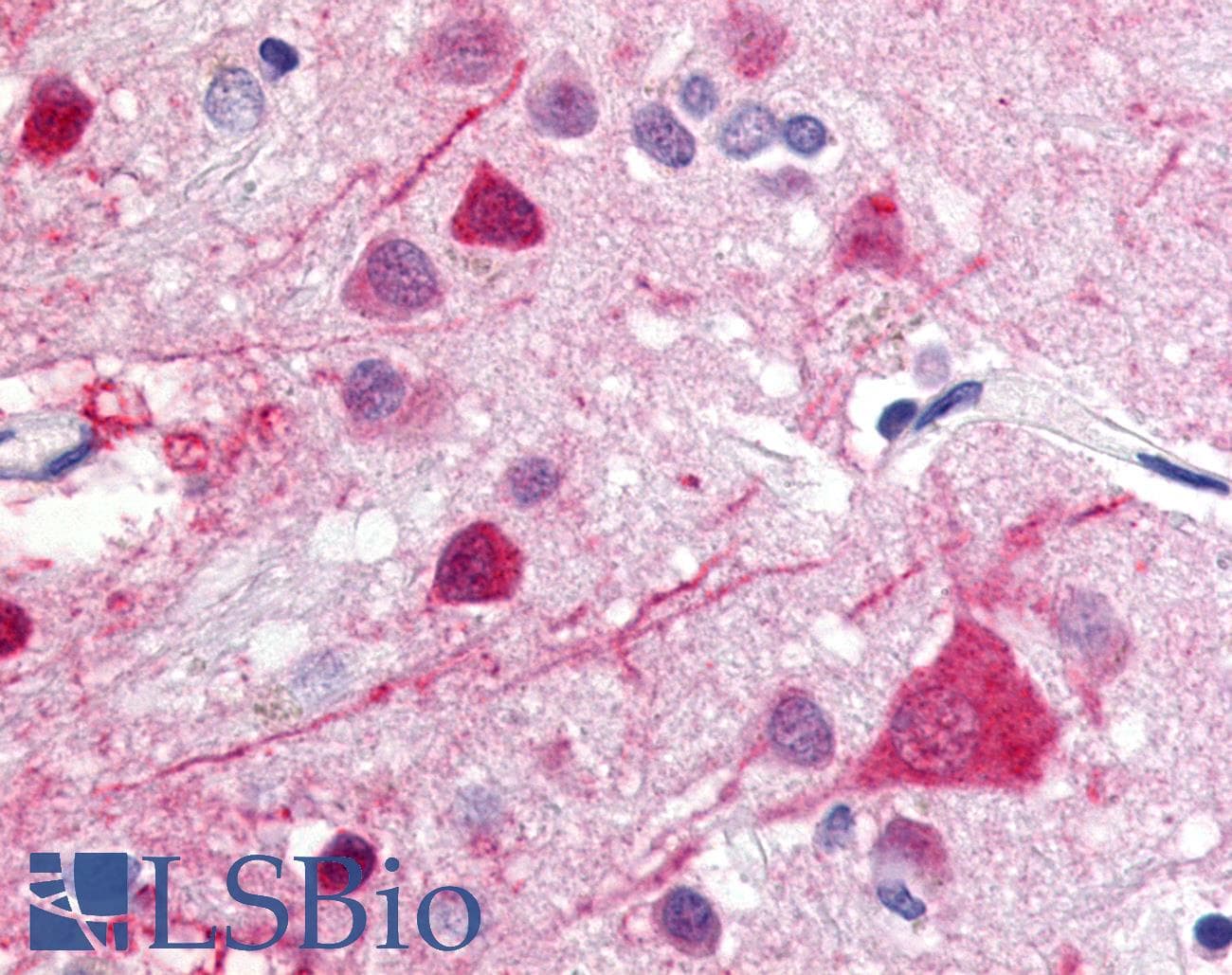 IHC-plus™ GPR52 Antibody (Cytoplasmic Domain)