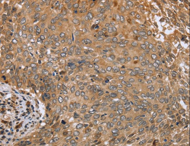 CLEC16A / KIAA0350 Antibody