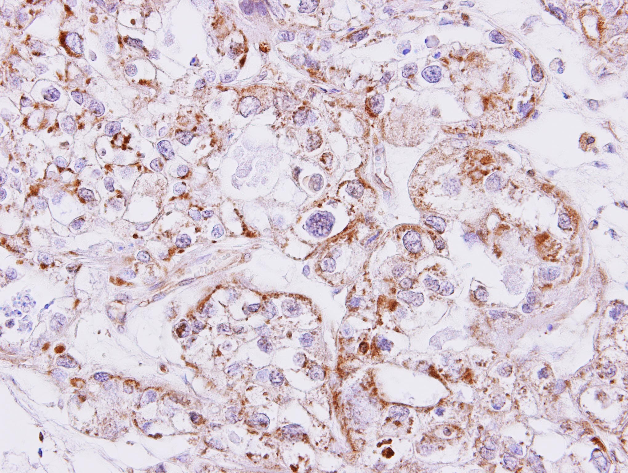 INHBA / Inhibin Beta A Antibody (aa362-426)