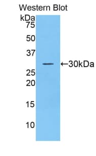 ADAM20 Antibody (aa367-615, HRP)
