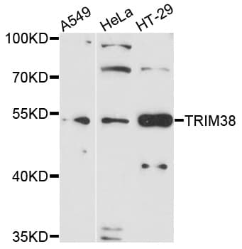 TRIM38 Antibody