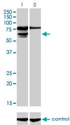 PGM3 Antibody (clone 1E2-1B12)