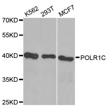 Polyclonal Rabbit anti-Human POLR1C / RPA39 Antibody (IHC, IF, WB)