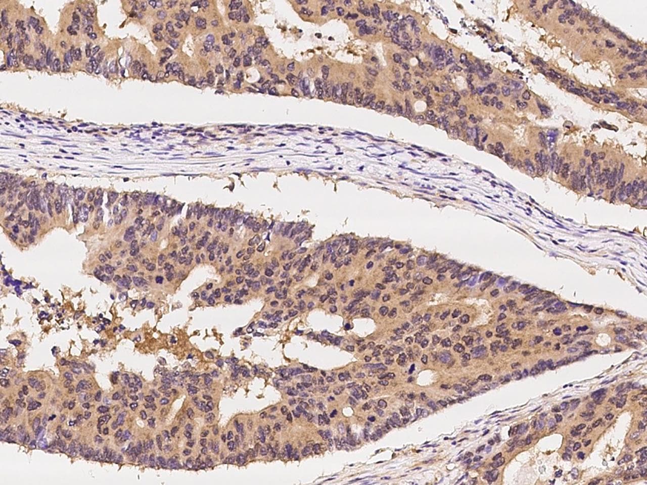 Polyclonal Rabbit anti-Human CCT3 Antibody (IHC, WB)